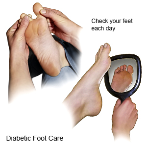 Diabetic  Foot Care